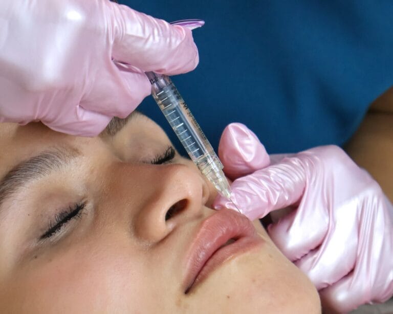 Aumento de labios con ácido hialurónico en ALUMED, San Pedro Garza García, Monterrey