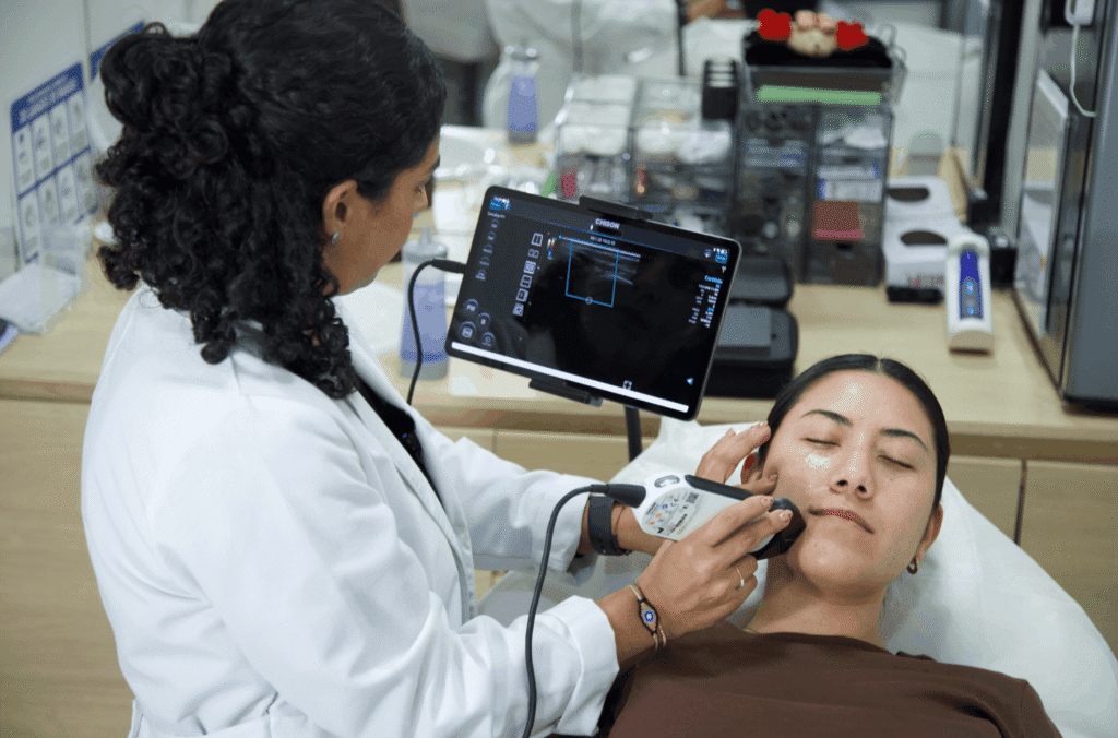 Mapeo vascular labial con ultrasonido Doppler antes de relleno de labios en ALUMED