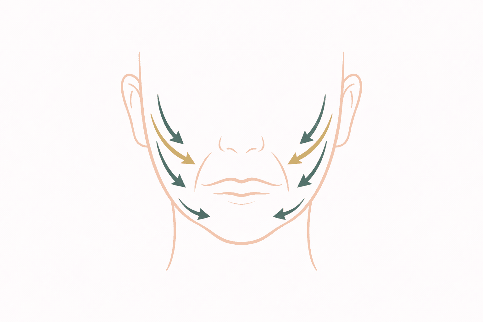 Zonas de flacidez facial: jowls, surcos nasogenianos, línea mandibular, cuello