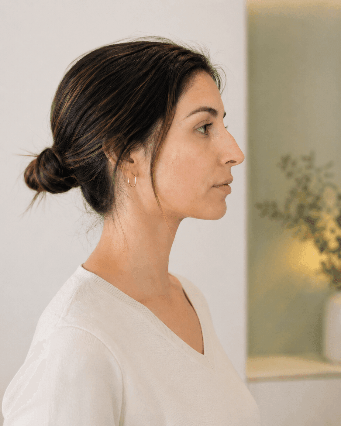 Rinomodelación sin cirugía con seguridad Doppler en ALUMED San Pedro Garza García