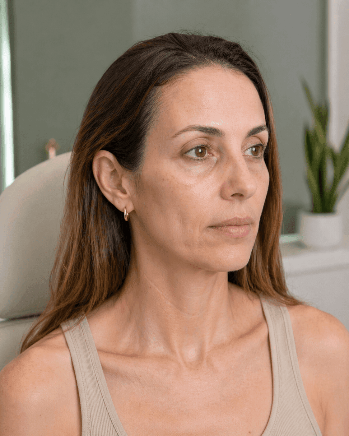 Pérdida de volumen facial y mejillas hundidas después de bajar de peso con Ozempic o GLP-1