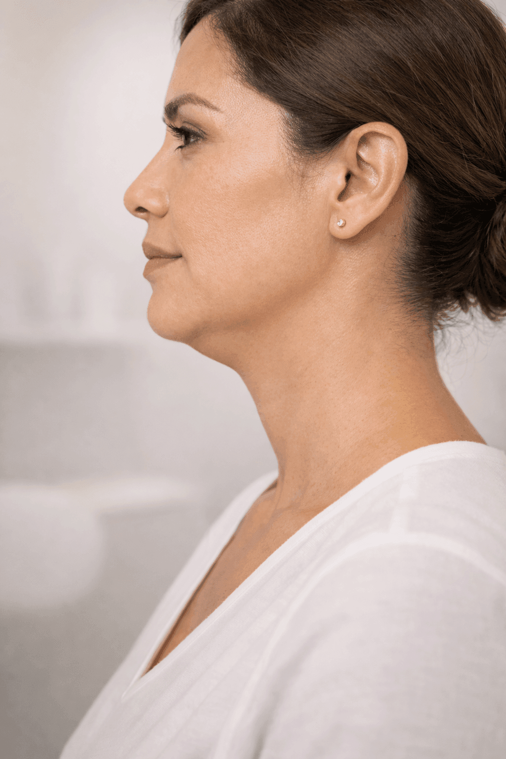 Papada y doble mentón: grasa submentoniana resistente a dieta y ejercicio