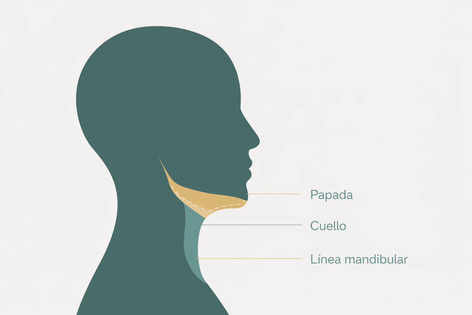 Zonas de tratamiento: papada, cuello y línea mandibular con lipólisis láser