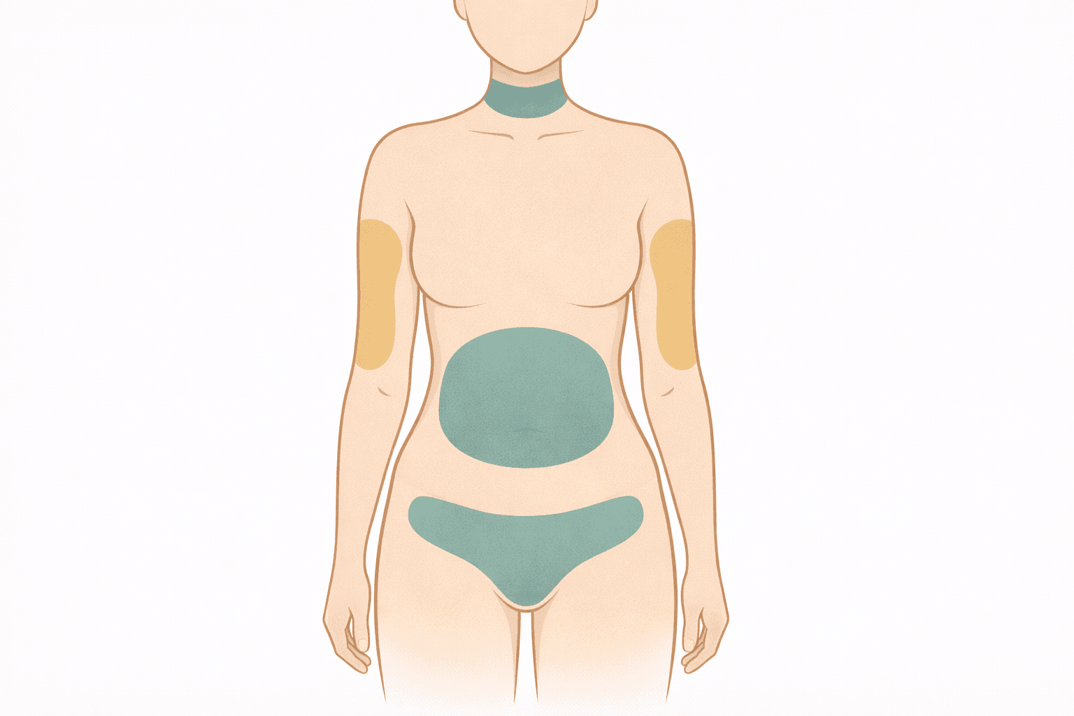 Zonas de piel flácida después de pérdida de peso: abdomen, brazos, muslos, cuello