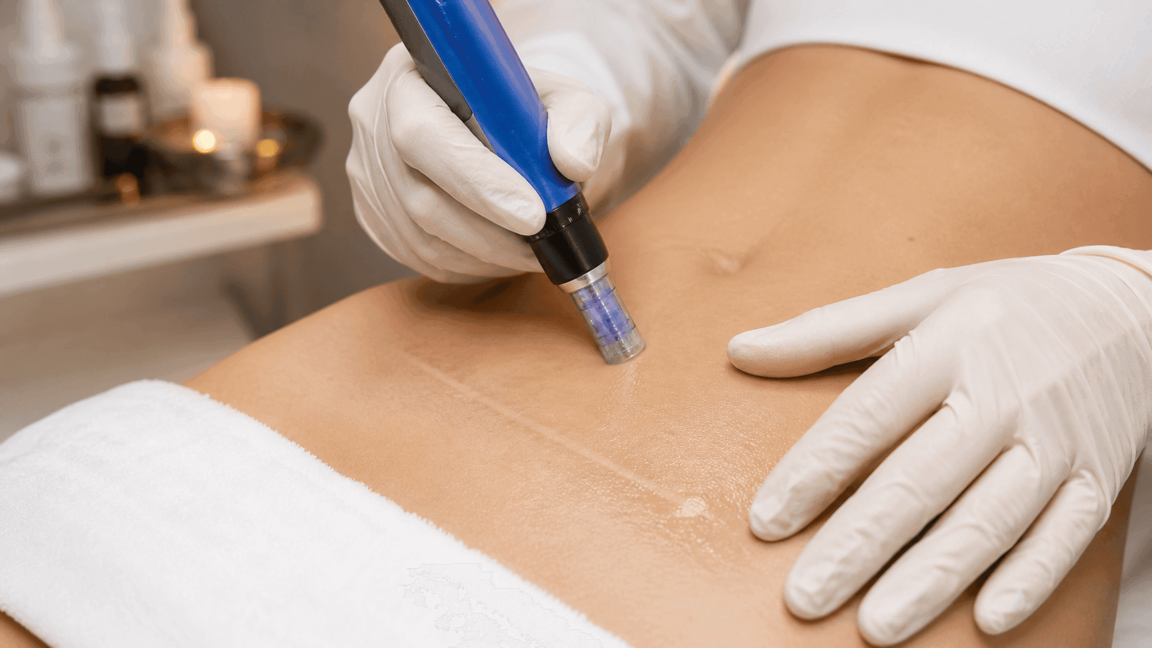 Recuperación postquirúrgica con protocolos médicos y fotobiomodulación en ALUMED San Pedro Garza García