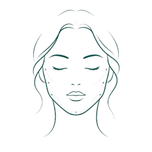 2. Armonización Facial — Ácido Hialurónico